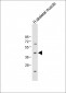 ADIPOR2 Antibody (Center)